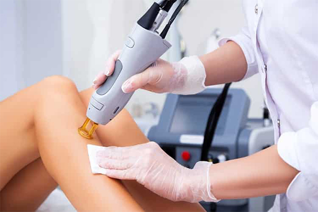 Laser-Hair-Removal