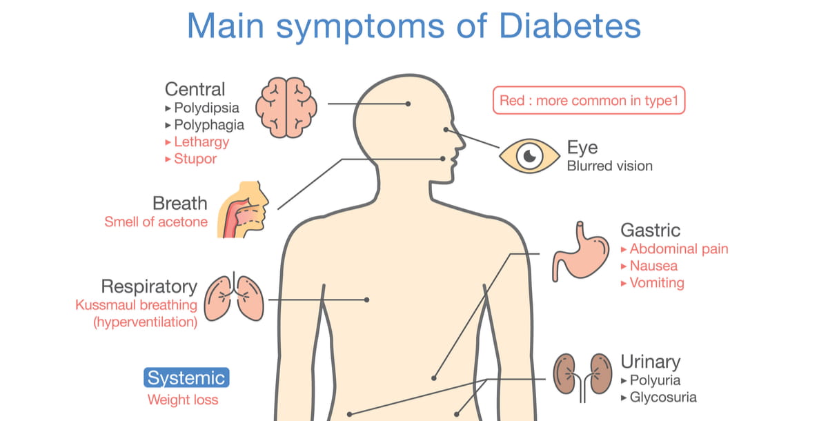 Type 2 Diabetes