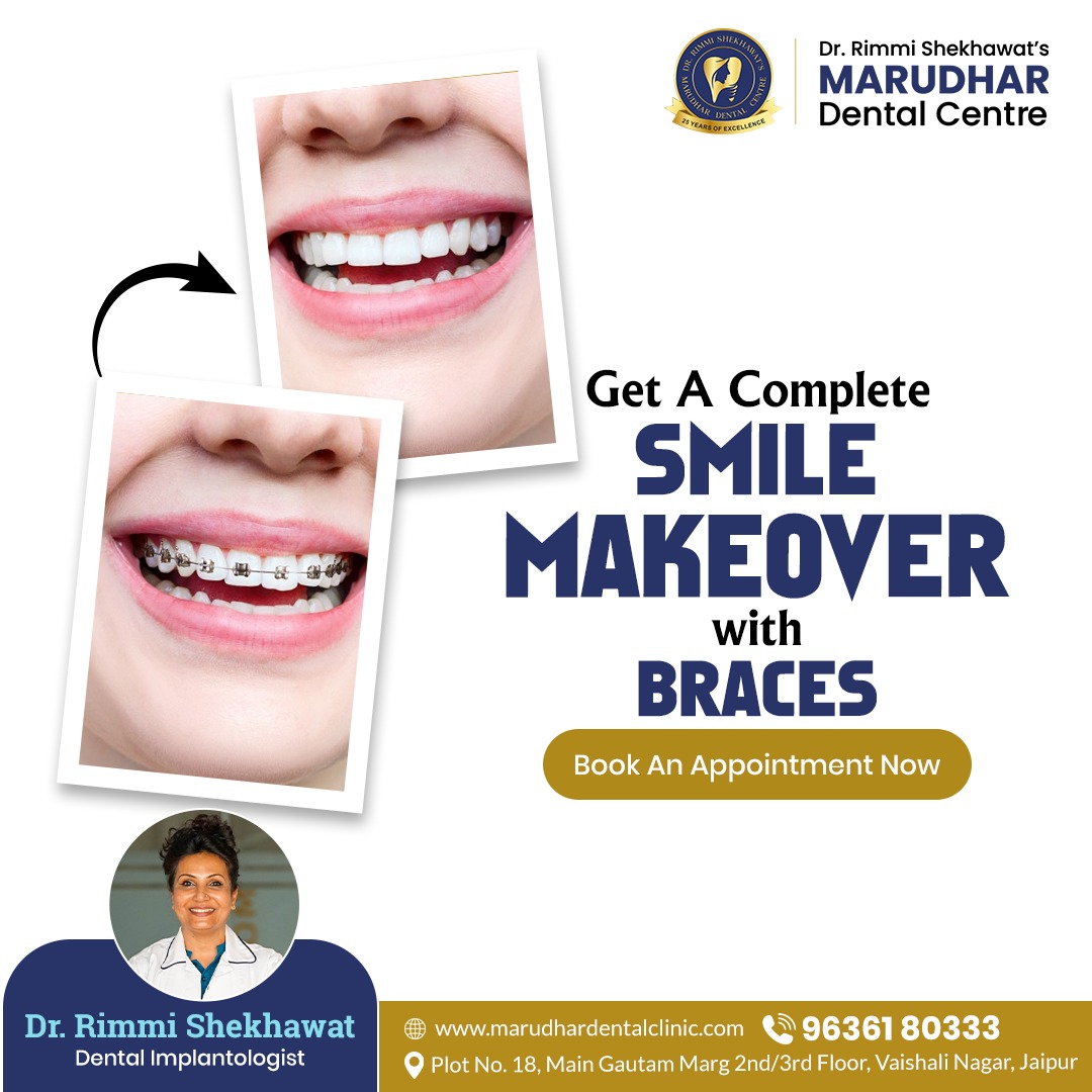 Best Dentist in Jaipur for your smile