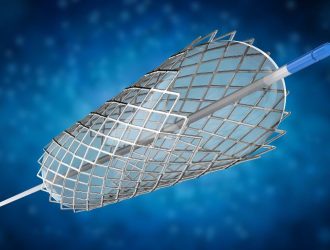 Europe Aortic Stent Graft Market