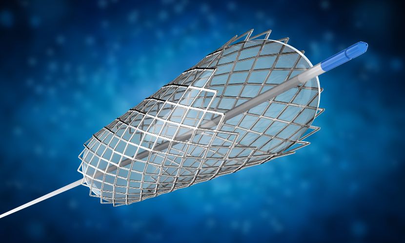 Europe Aortic Stent Graft Market