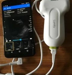 Philips Point of Care Ultrasound