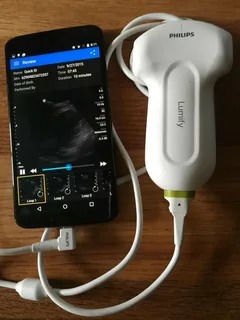 Philips Point of Care Ultrasound