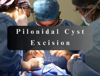 pilonidal cyst excision