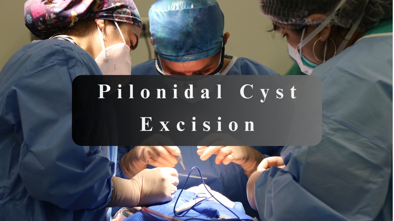 pilonidal cyst excision