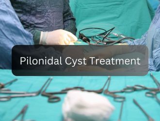 pilonidal cyst treatment (1)