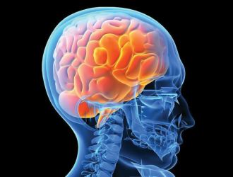 Brain Injury Rehabilitation in Gurgaon