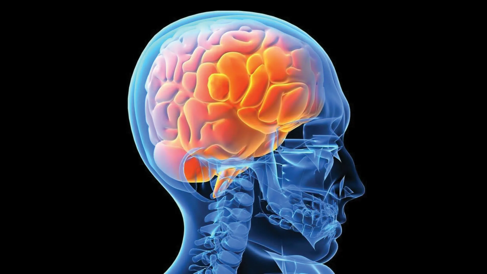 Brain Injury Rehabilitation in Gurgaon