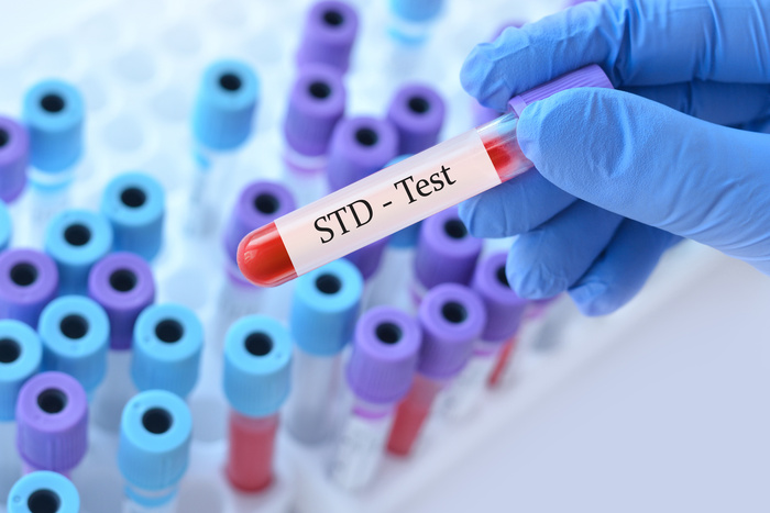 Confidential STD Testing Why Privacy Matters in Sexual Health