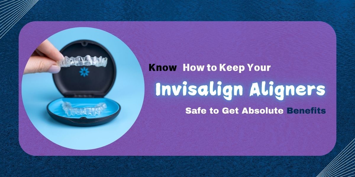 Know How to Keep Your Invisalign Aligners Safe to Get Absolute Benefits(1)