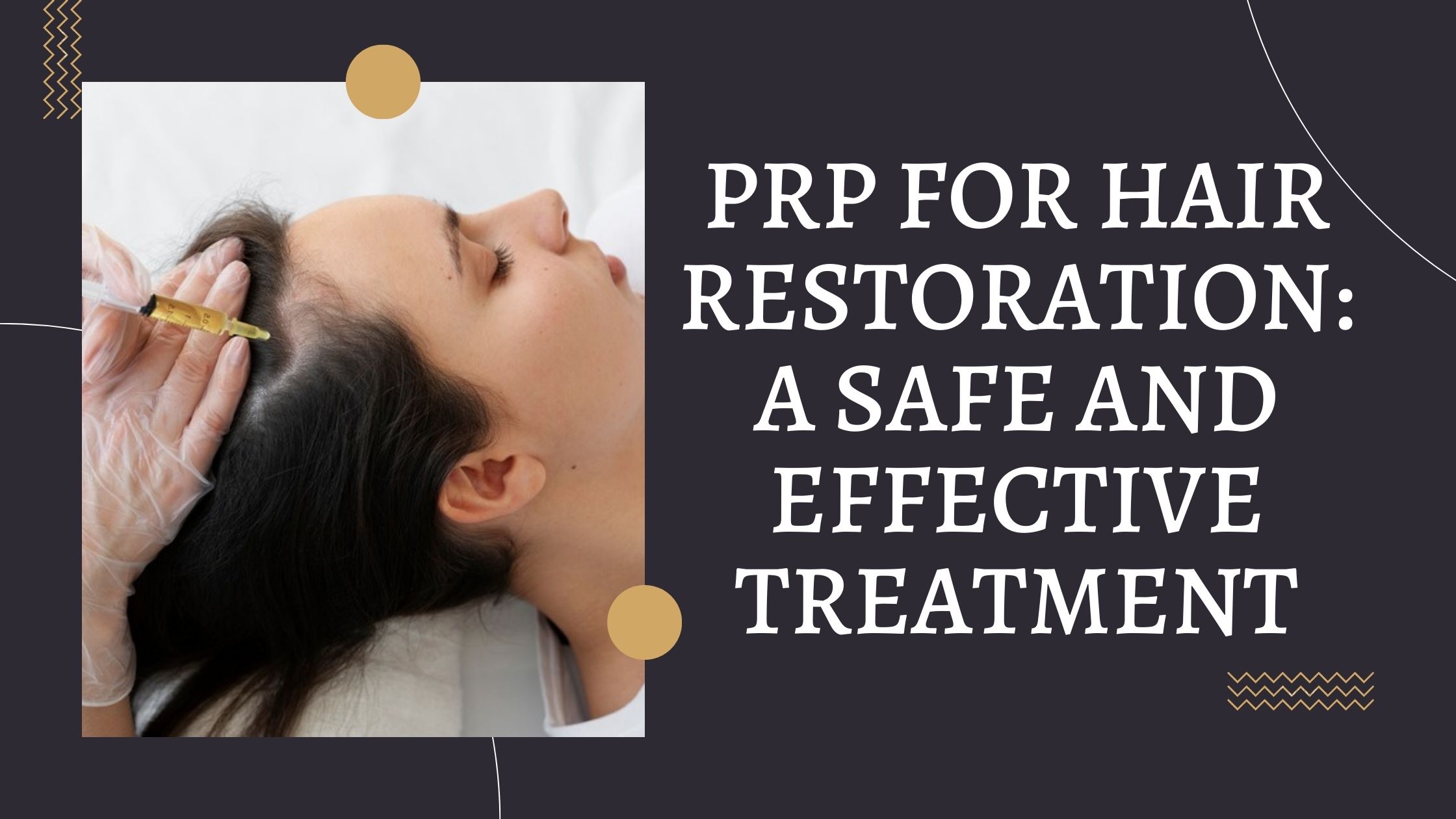 PRP for Hair Restoration A Safe and Effective Treatment