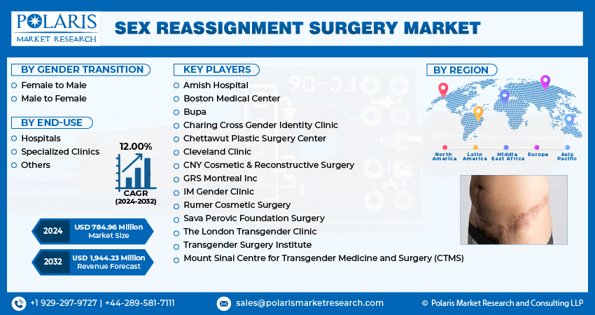 Sex Reassignment Surgery Market New (1)