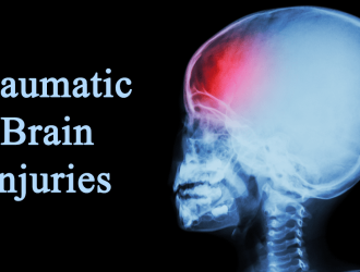 Traumatic Brain Injury in Hyderabad