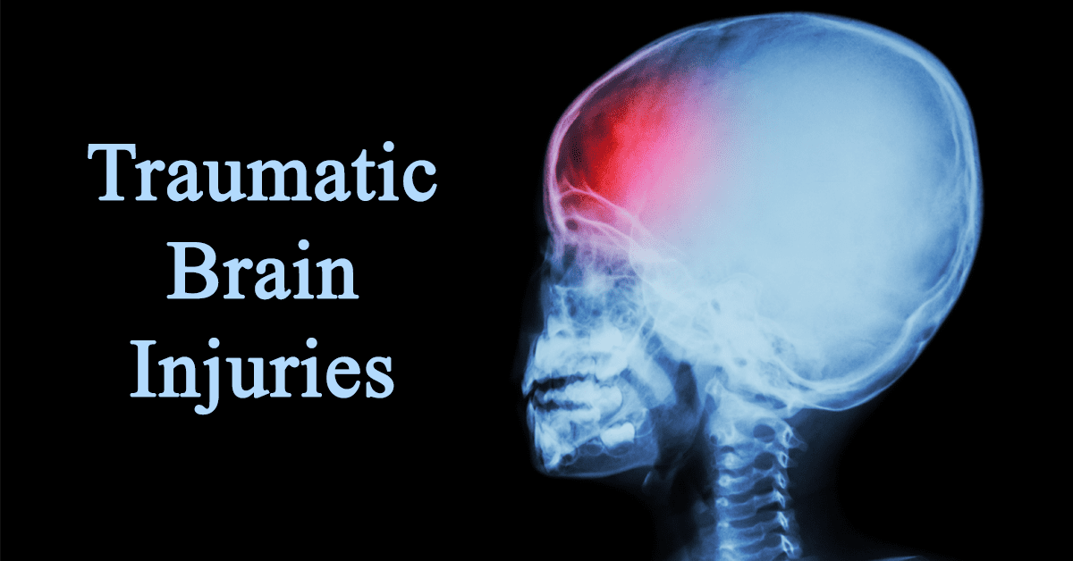 Traumatic Brain Injury in Hyderabad