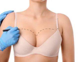 breast lift in dubai