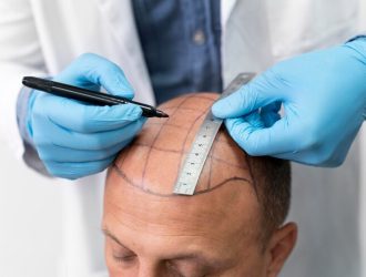 male-going-through-follicular-unit-extraction-process_23-2149106326