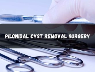 pilonidal cyst removal surgery