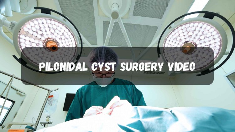 pilonidal cyst surgery video