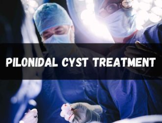 pilonidal cyst treatment