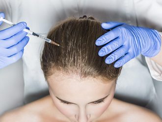 prp hair treatment dubai