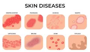 skin rash