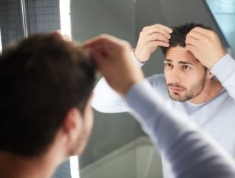 stages-of-hair-loss