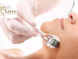 How-Many-Microneedling-Treatments-Do-You-Need