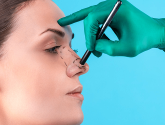 How to Prepare for Your Rhinoplasty Consultation Key Questions to Ask