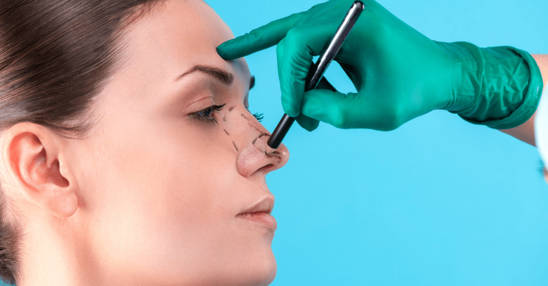 How to Prepare for Your Rhinoplasty Consultation Key Questions to Ask