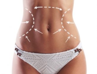 The Complete Guide to Tummy Tuck Recovery Tips and Advice