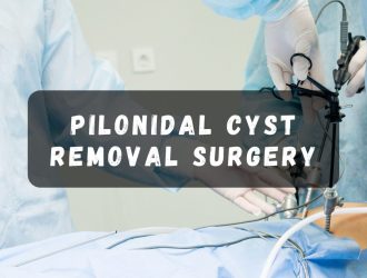 pilonidal cyst removal surgery